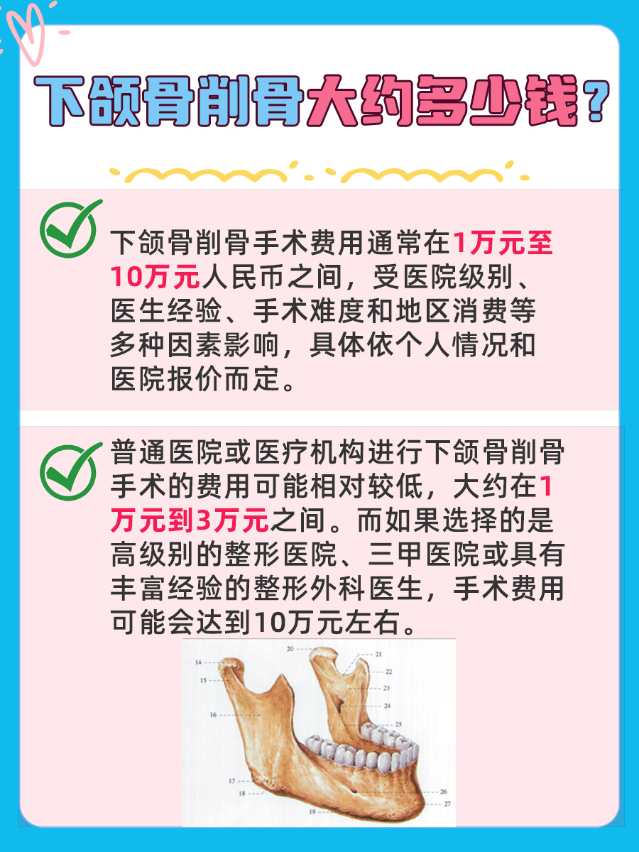 下颌骨削骨大约多少钱，你知道吗?