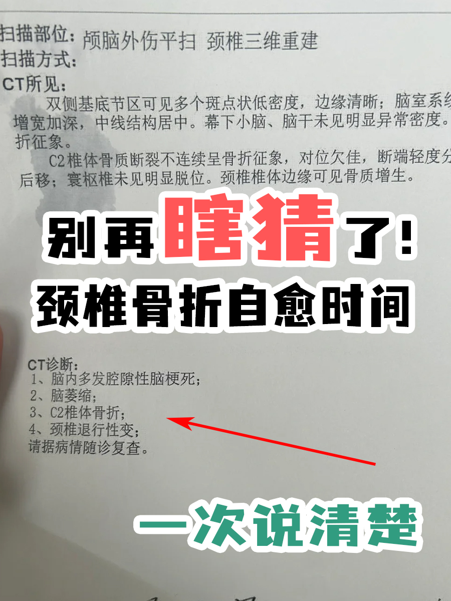 别再瞎猜了!颈椎骨折自愈时间一次说清楚