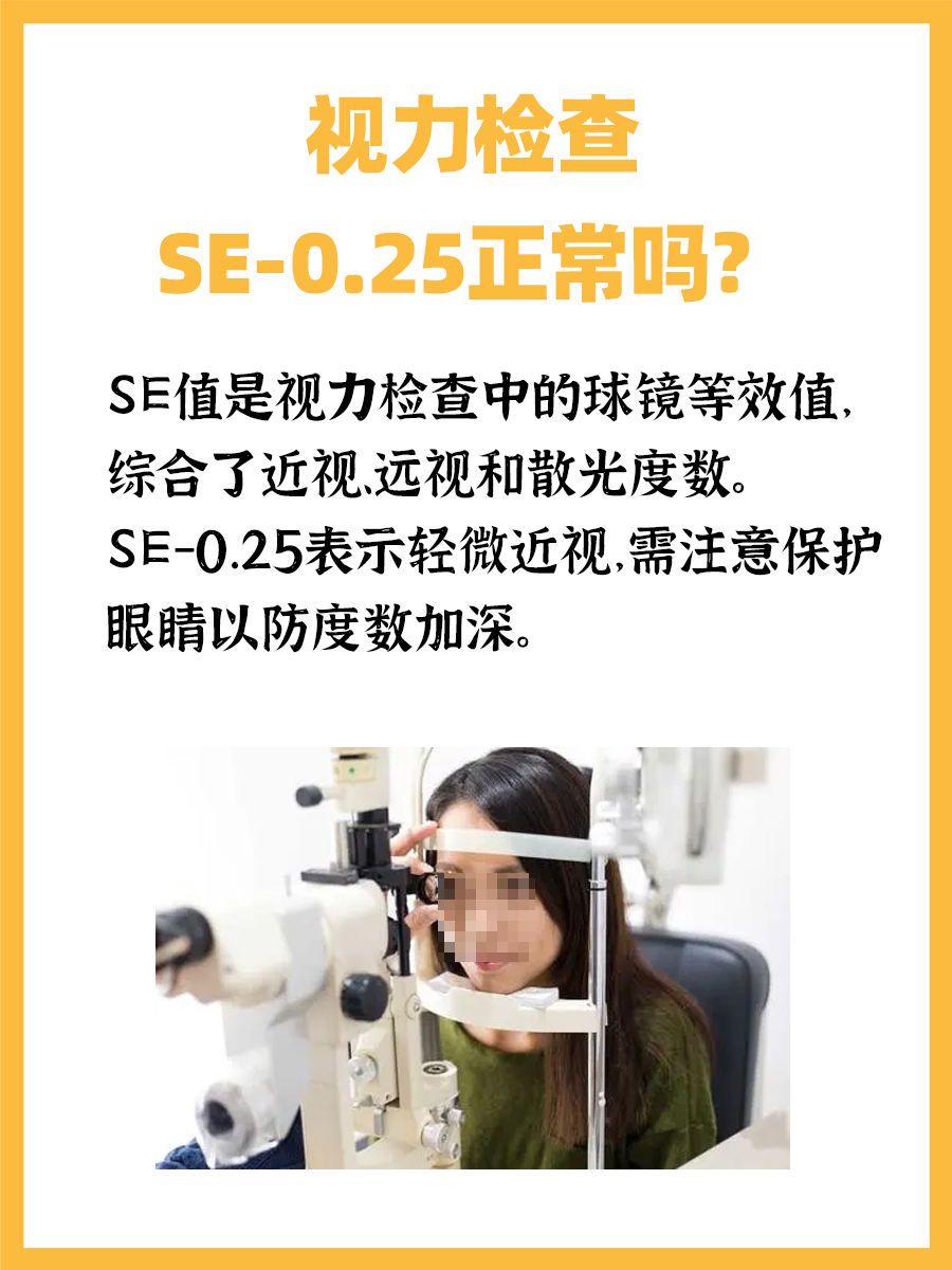 视力检查SE-0.25，你的视力还好吗？