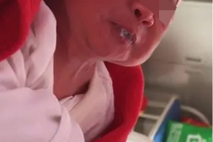 婴儿强直-阵挛发作早期症状图