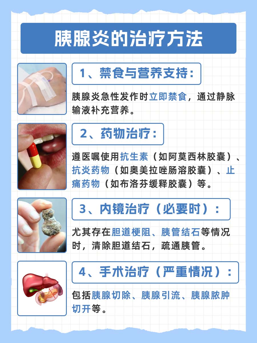 胰腺炎：医生告诉你警惕这些症状