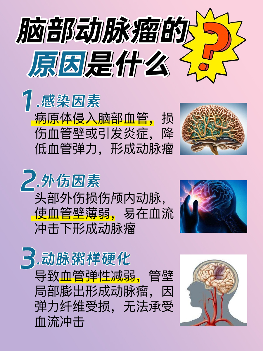 脑部动脉瘤:医生告诉你原因