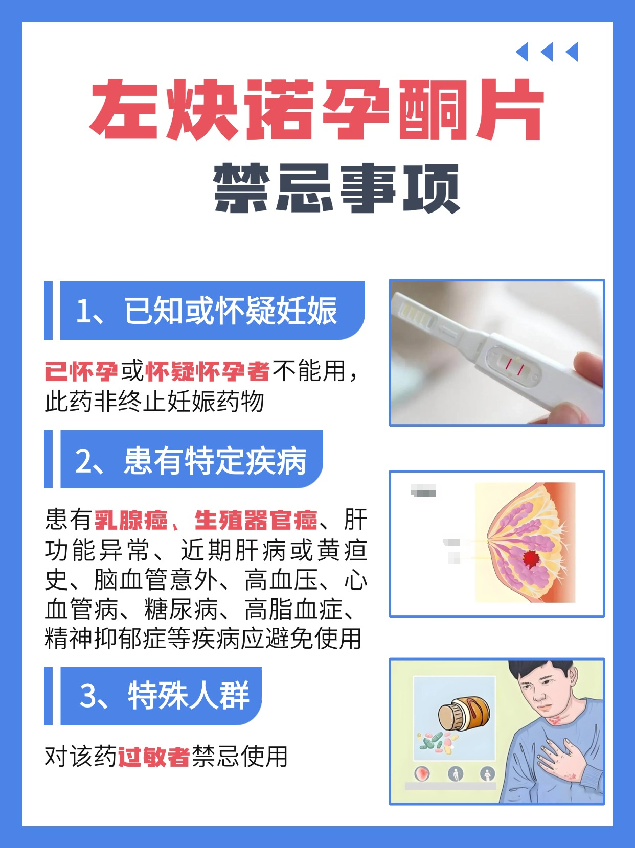 服用左炔诺孕酮片72小时内发生第二次性生活？