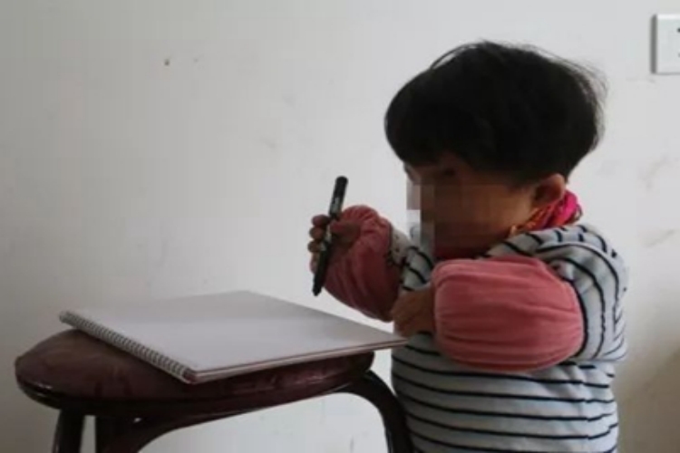 黏多糖病患儿身材矮小图