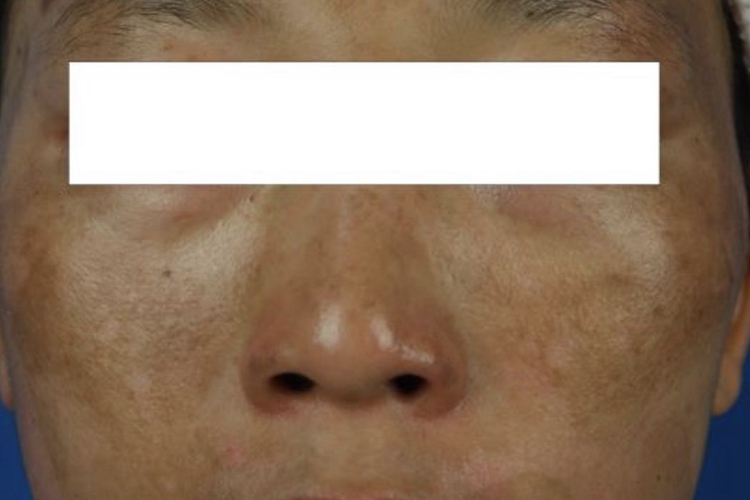 男人肾阳虚脸部症状图