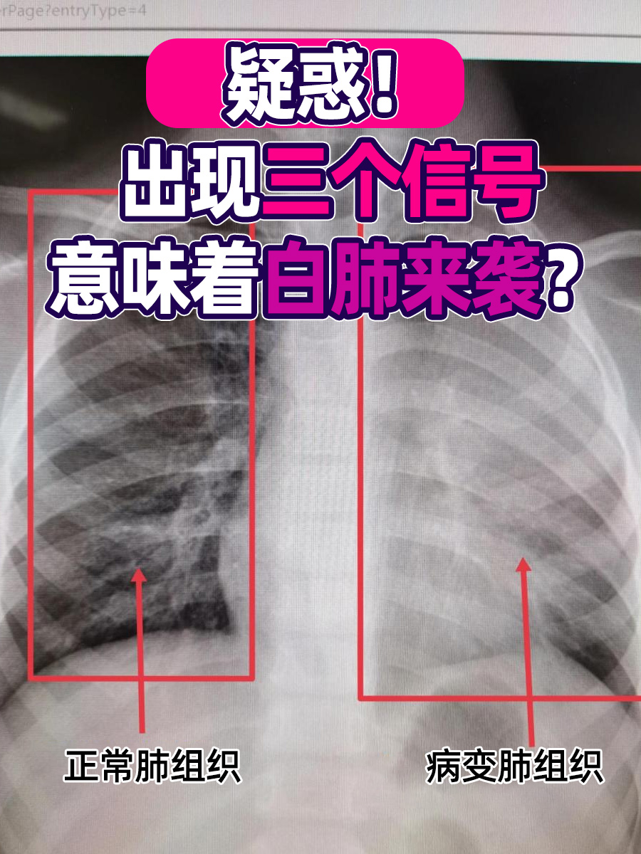 疑惑！出现三个信号，意味着白肺来袭？