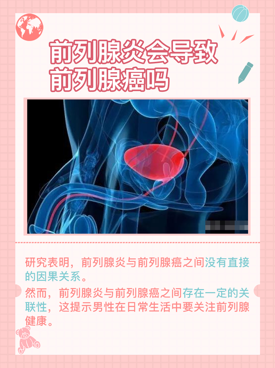 前列腺炎会导致前列腺癌吗，医生告诉你