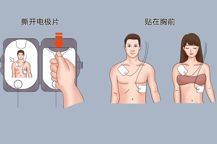 贴片流程图