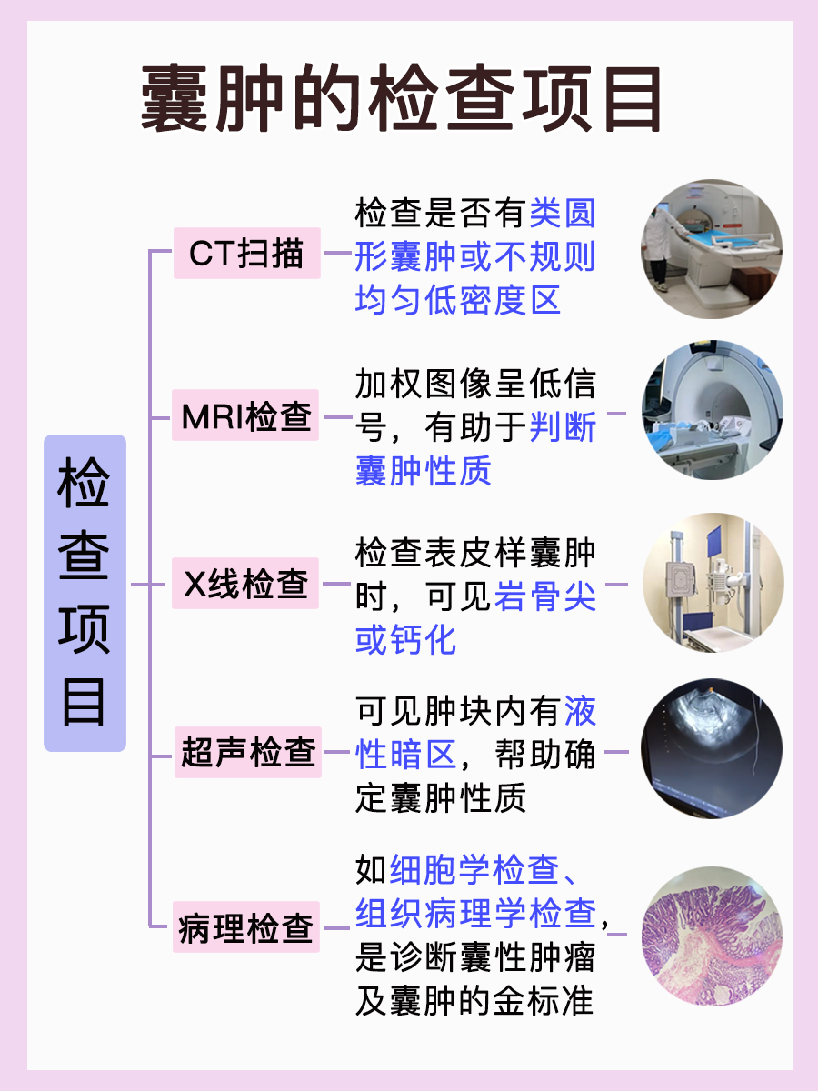 囊肿来袭!它的触感是硬邦邦还是软绵绵?