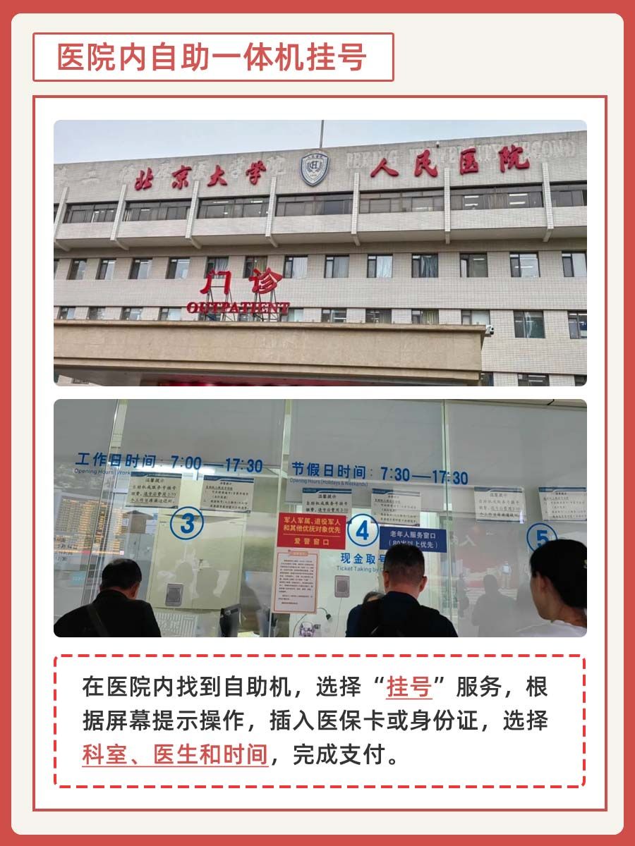 北大人民医院蔡林医生怎么样?怎么挂号?