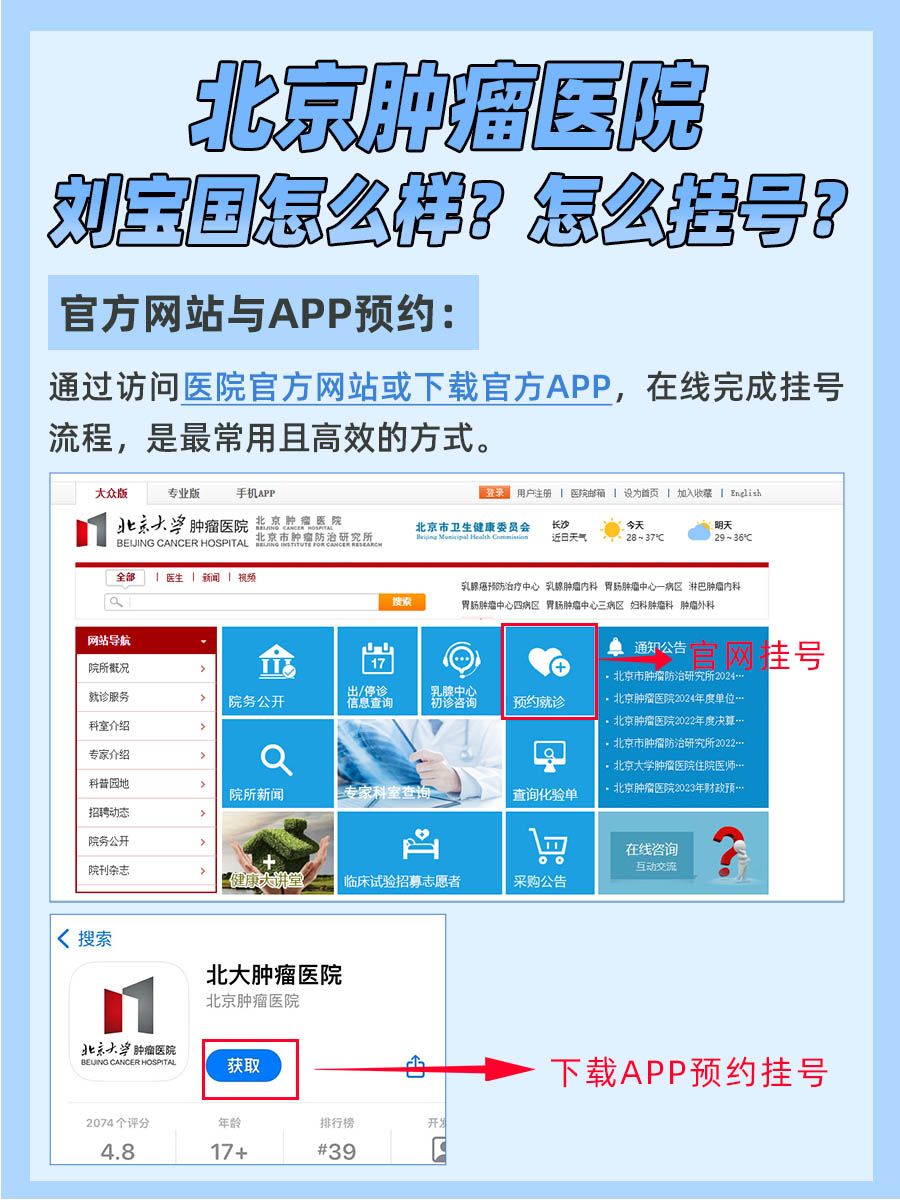 北京肿瘤医院刘宝国怎么样？怎么挂号？