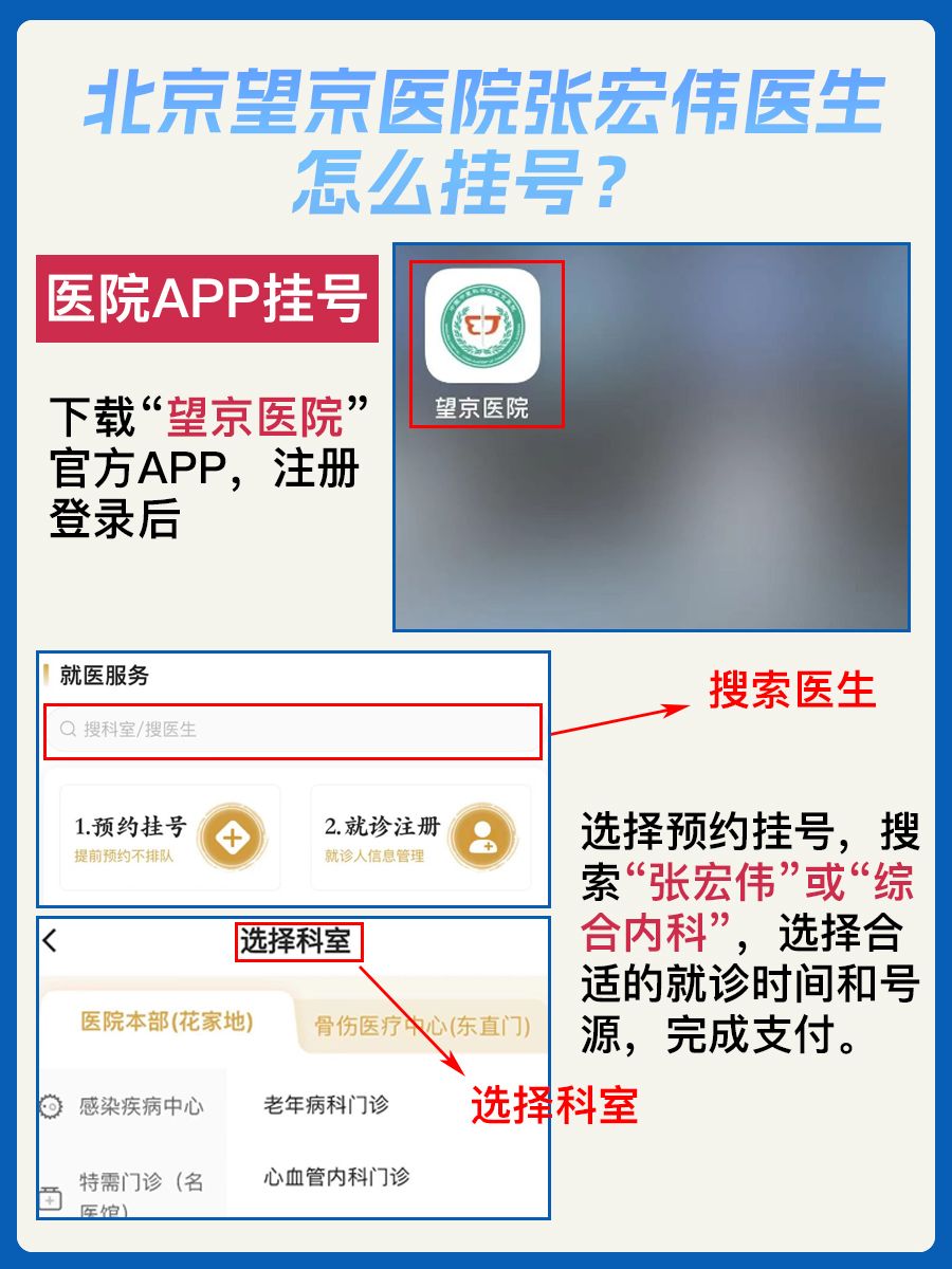 北京望京医院张宏伟医生怎么样？怎么挂号？
