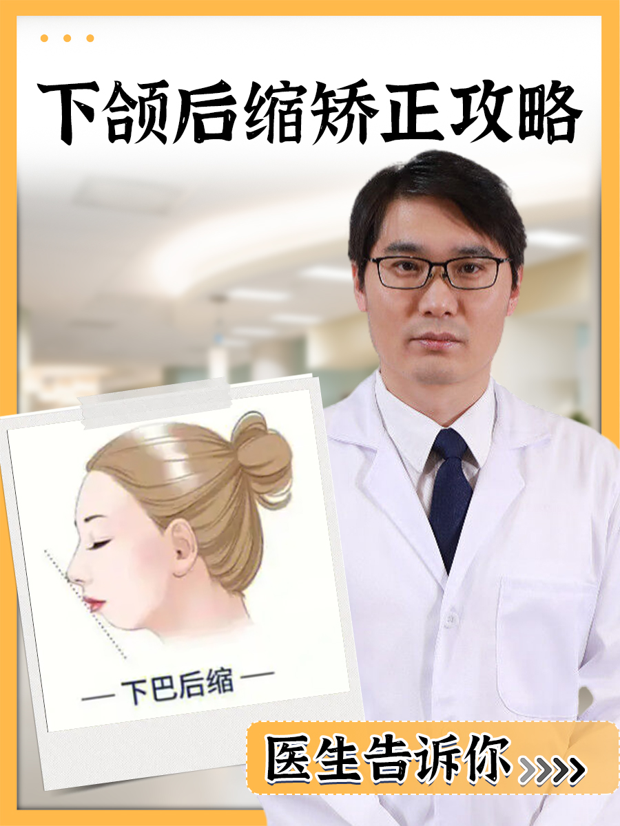 下颌后缩矫正攻略：医生告诉你