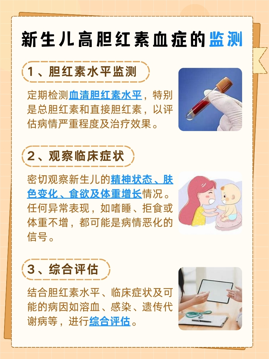 详解新生儿高胆红素血症护理措施