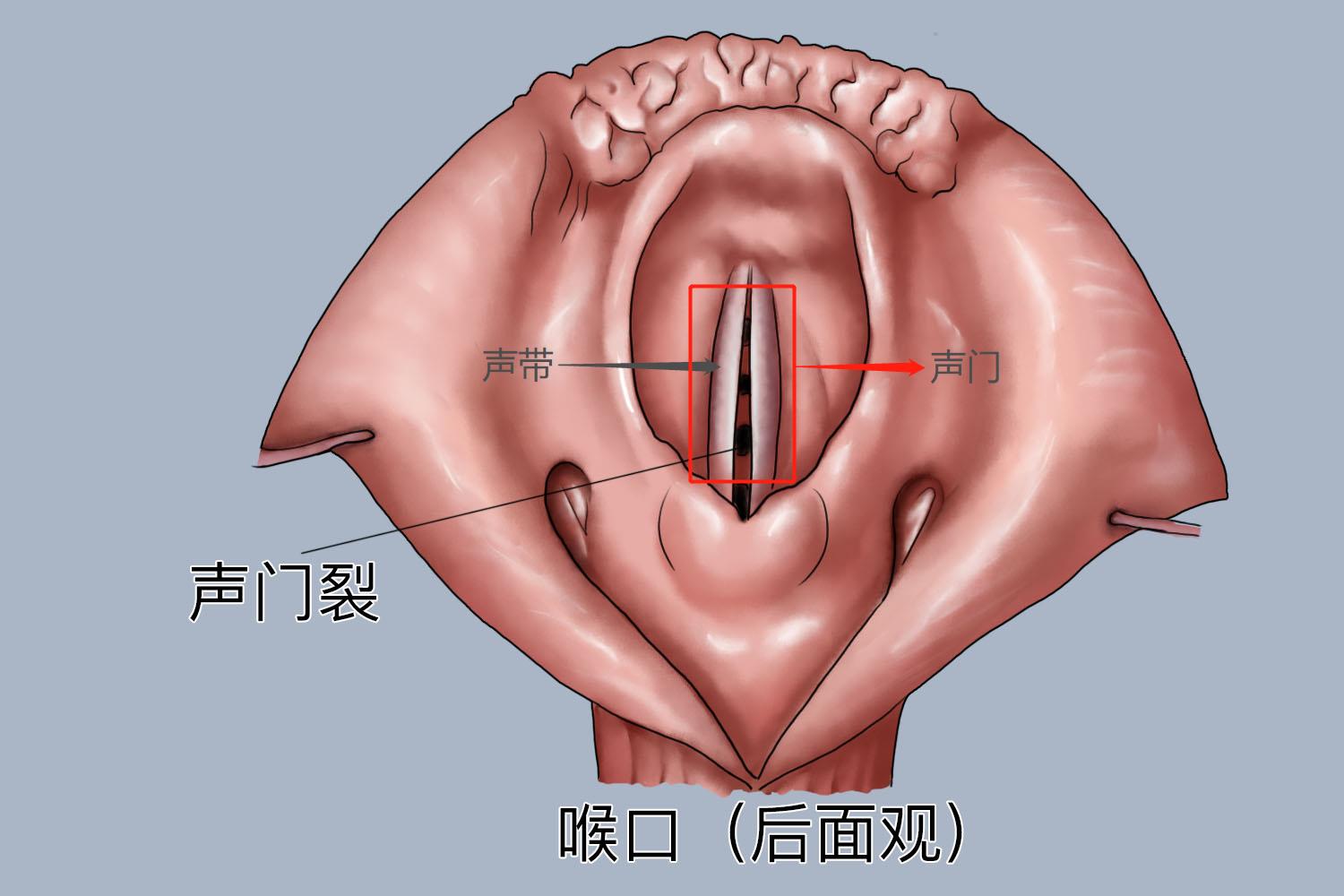 声门解剖图