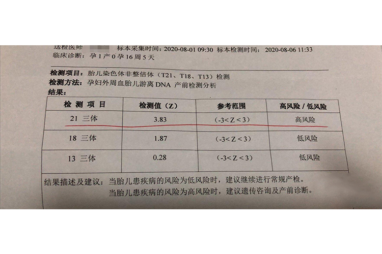 无创DNA检查报告单高风险图 无创DNA检查报告单高风险图