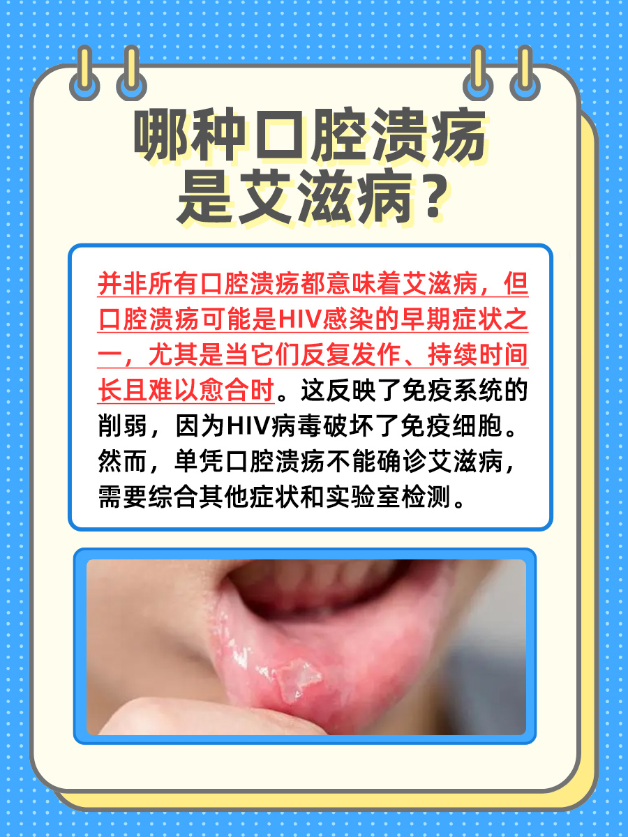艾滋病:口腔溃疡的症状与检查方法