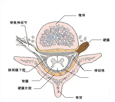 脊髓空洞1.png