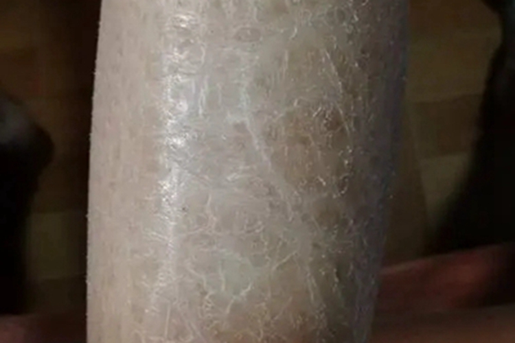 冬季瘙痒症裂纹图