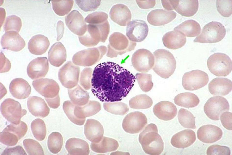 嗜碱性粒细胞图