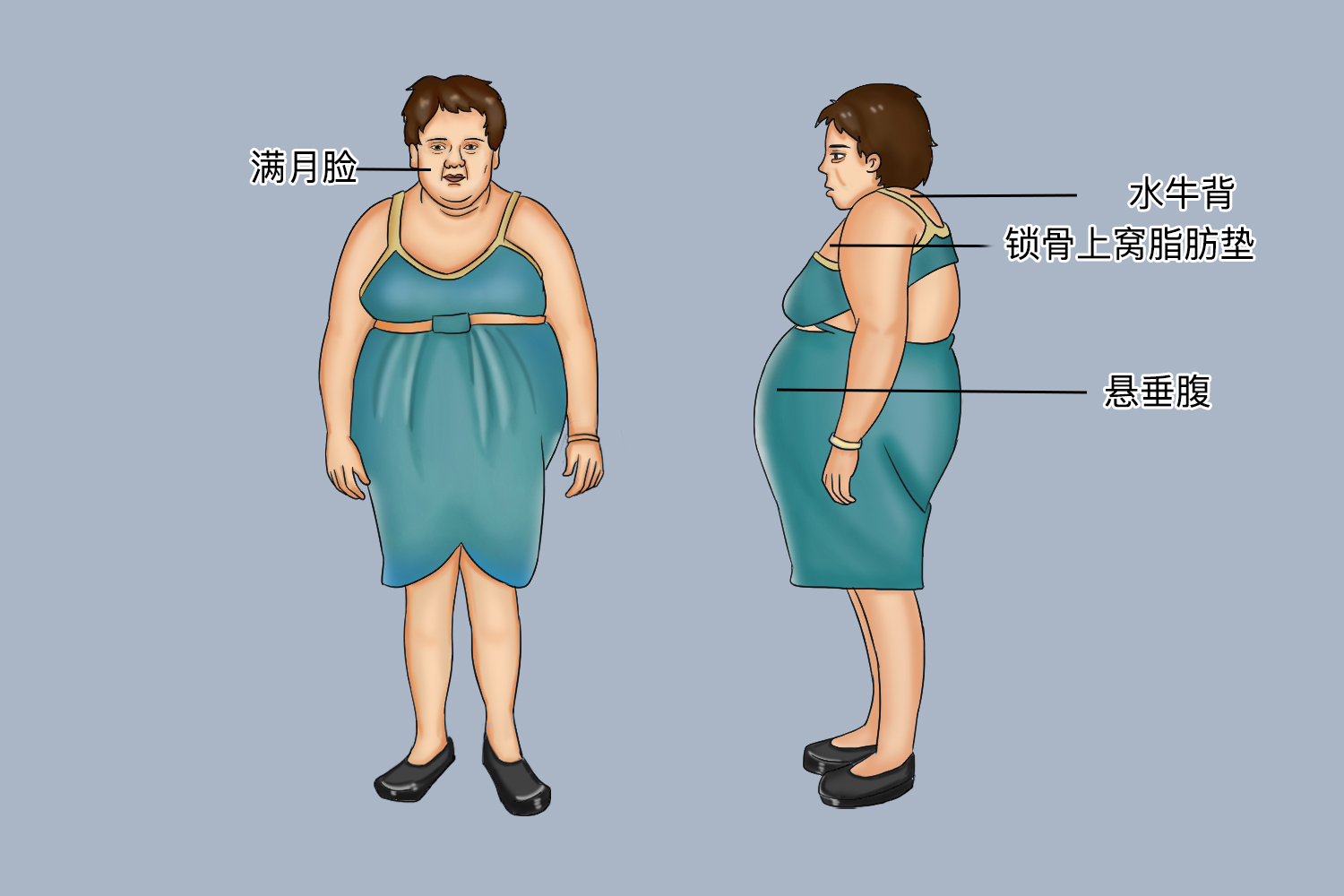 糖尿病体型特征图