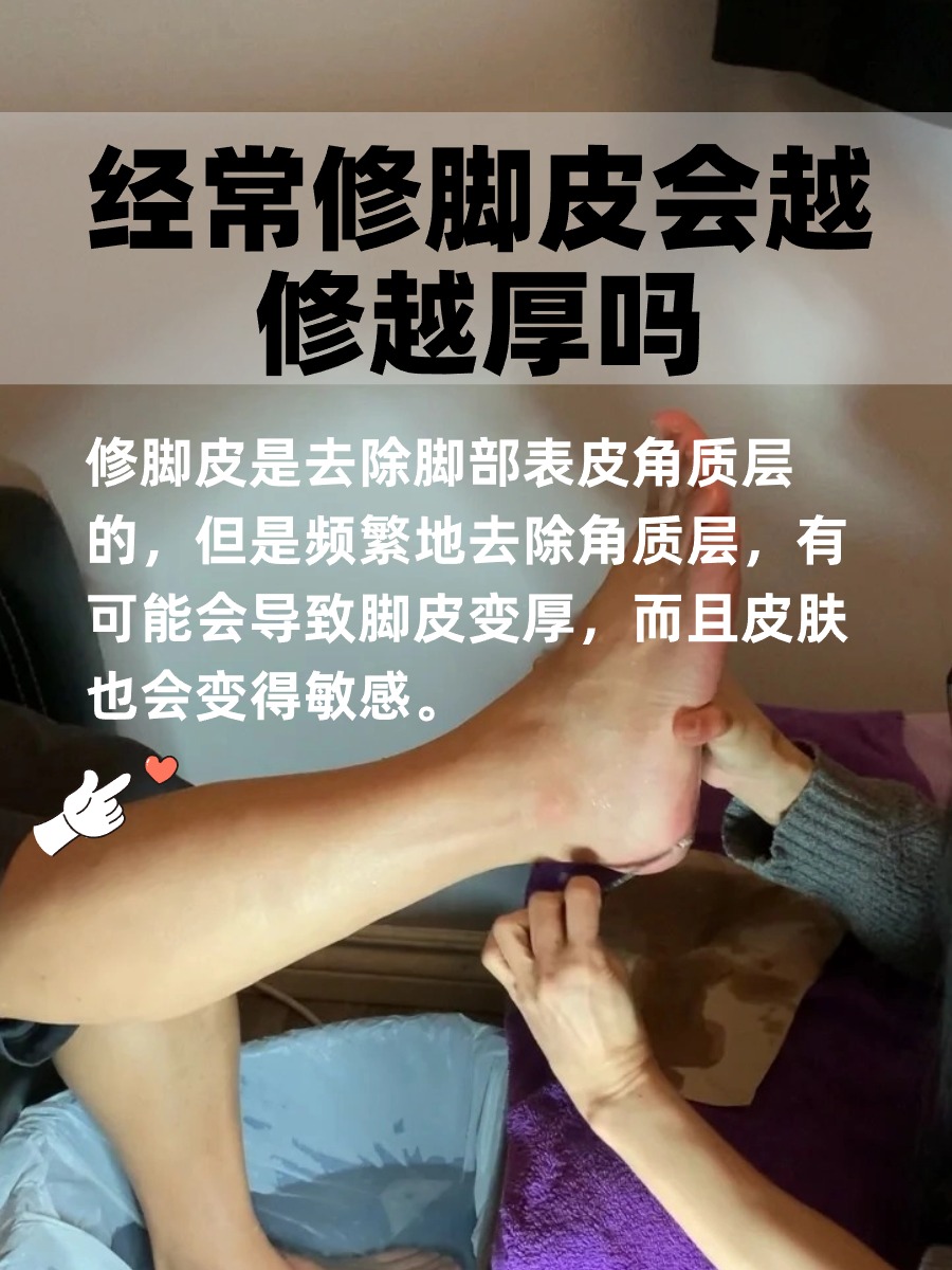 经常修脚皮，脚皮真的会变厚吗？医生来揭秘！