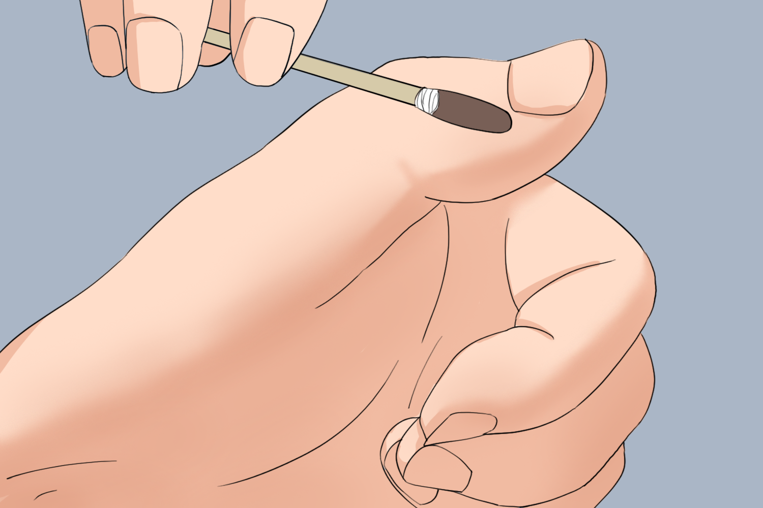 取穴部位消毒图