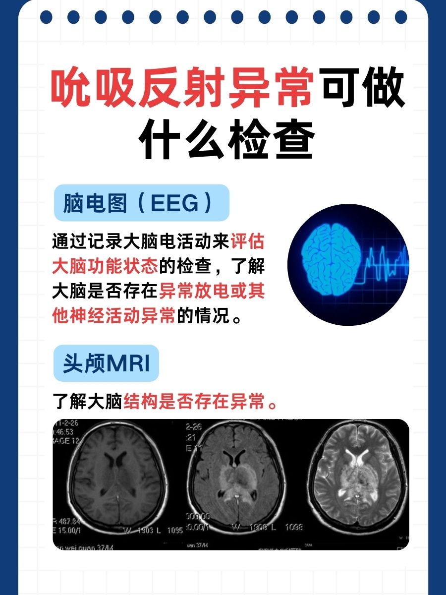 一文讲清：吮吸反射的神经中枢在哪？