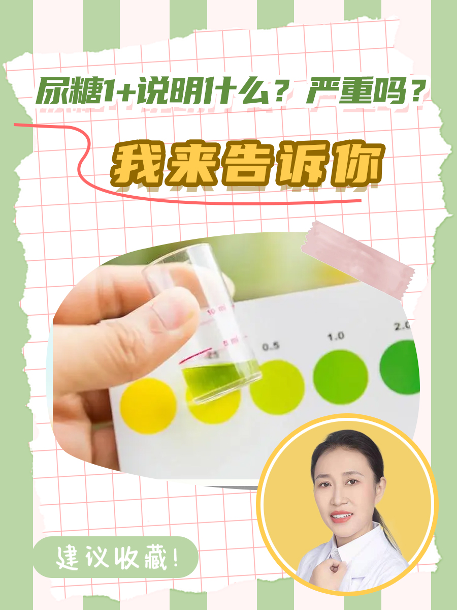 尿糖1+说明什么？严重吗？我来告诉你
