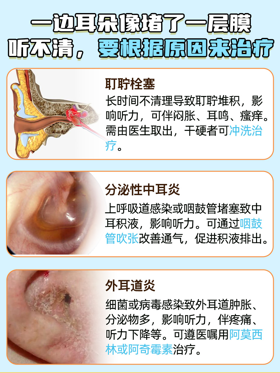 一边耳朵像堵了一层膜听不清，我来帮你搞定