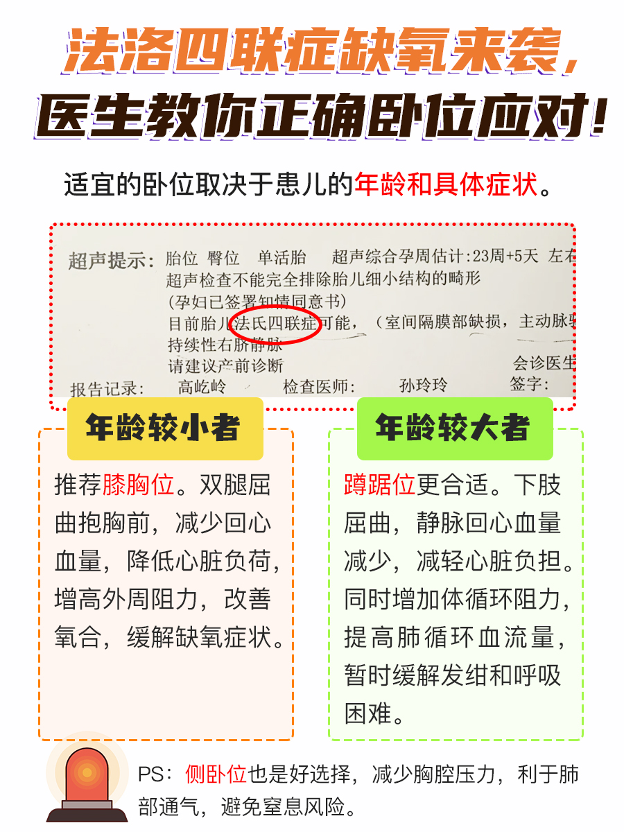 法洛四联症缺氧来袭，医生教你正确卧位！