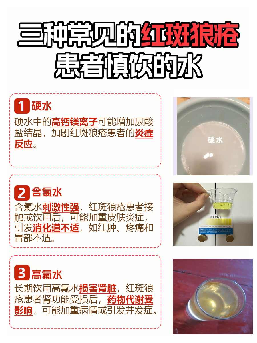 红斑狼疮患者慎饮！三水黑名单！