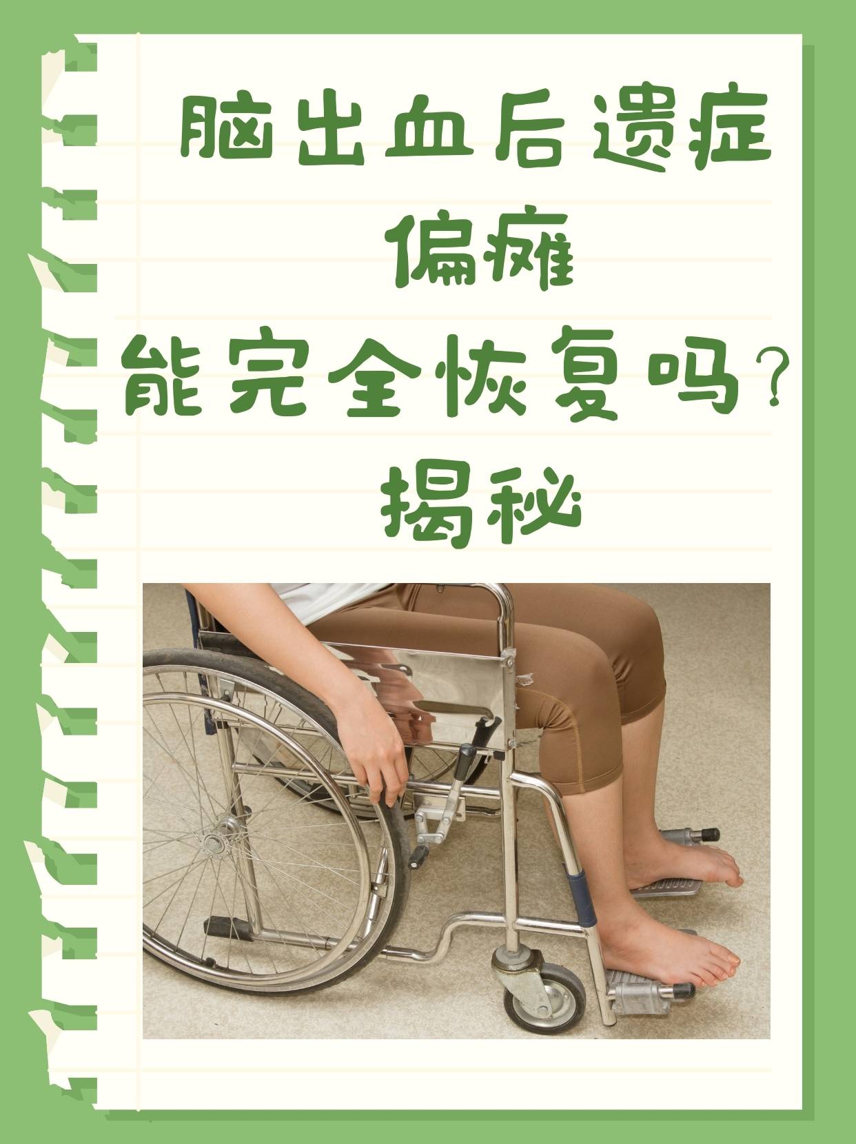 脑出血后遗症偏瘫能完全恢复吗？揭秘