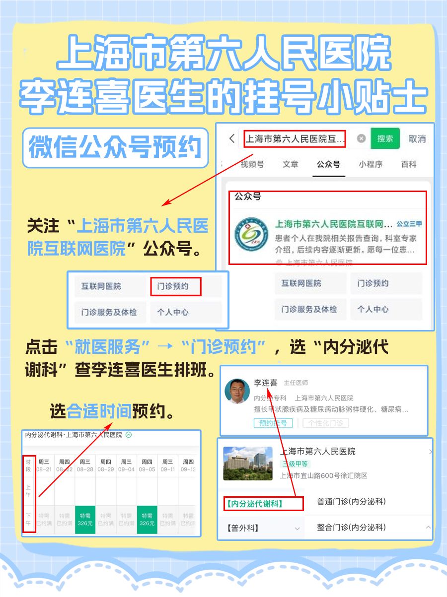 上海市第六人民医院李连喜医生怎么样?怎么挂号?