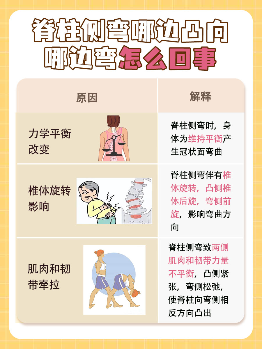 揭秘！脊柱侧弯哪边凸向哪边弯怎么回事