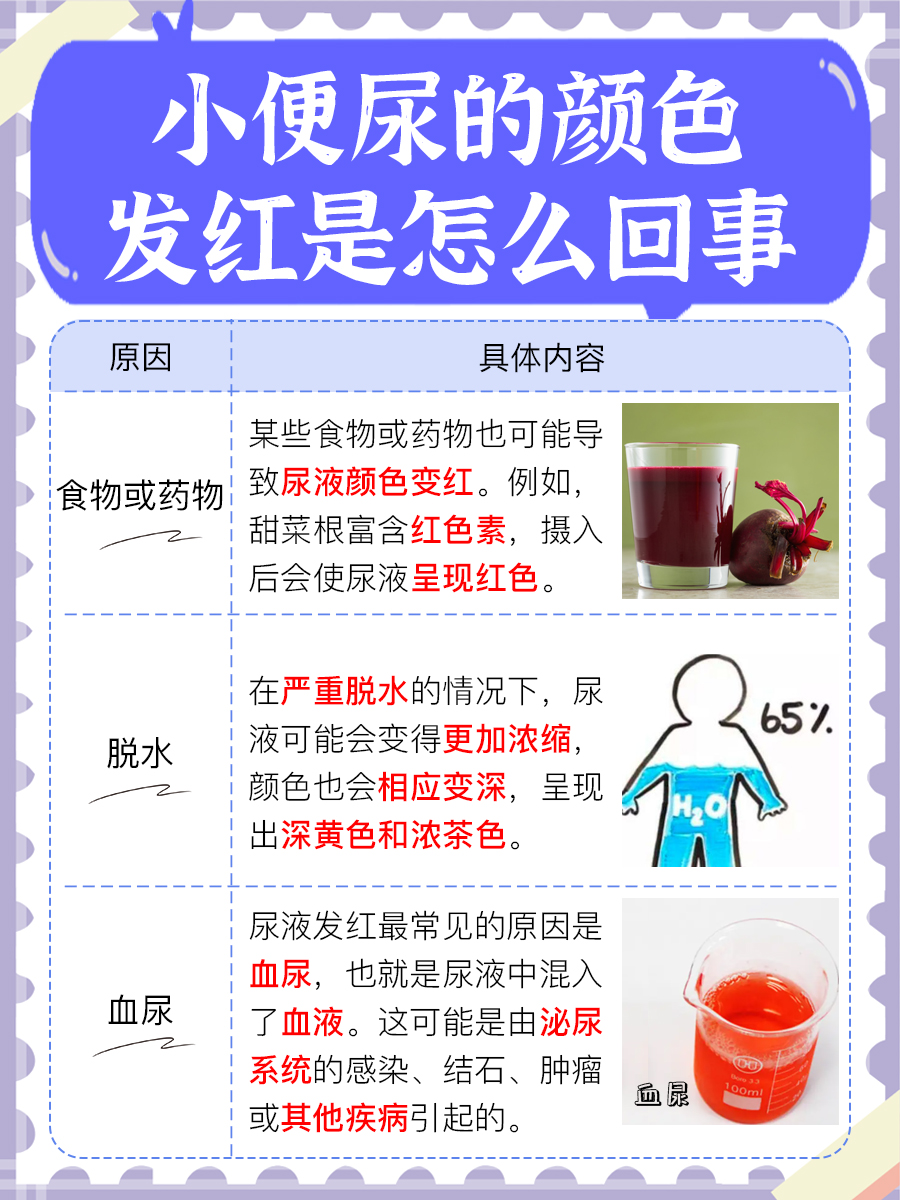 尿液呈现红色：揭秘小便颜色发红的原因