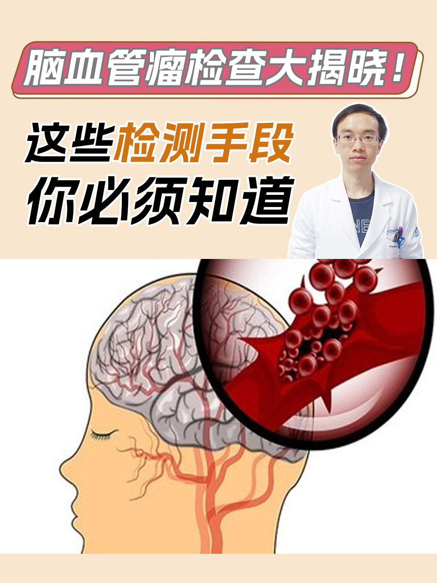 脑血管瘤检查大揭晓!这些检测手段你必须知道
