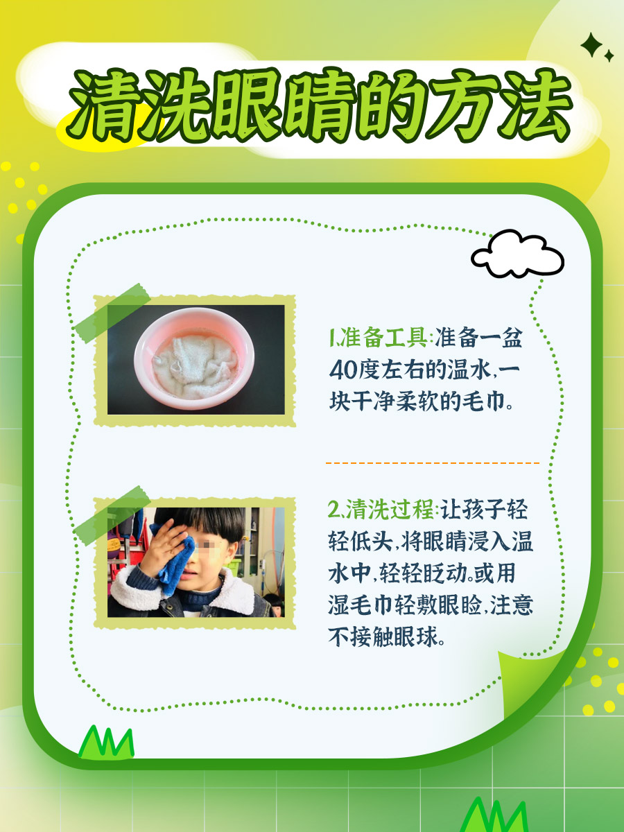 五岁孩子眼睛总眨，你知道背后的秘密吗？