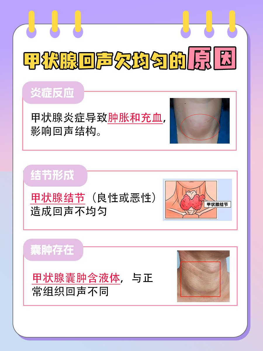 甲状腺回声欠均匀，这是什么原因？