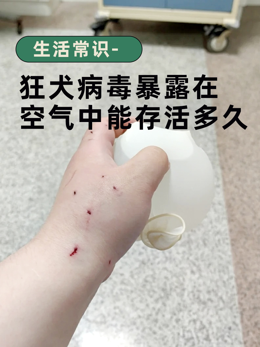 小常识：狂犬病毒暴露在空气中多久死亡
