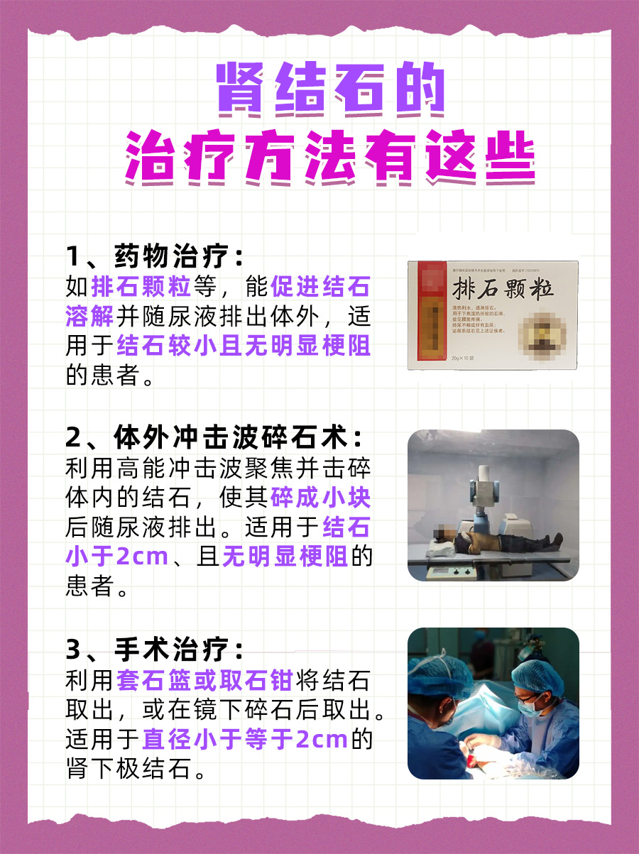 揭秘！肾结石3x2mm严重吗？