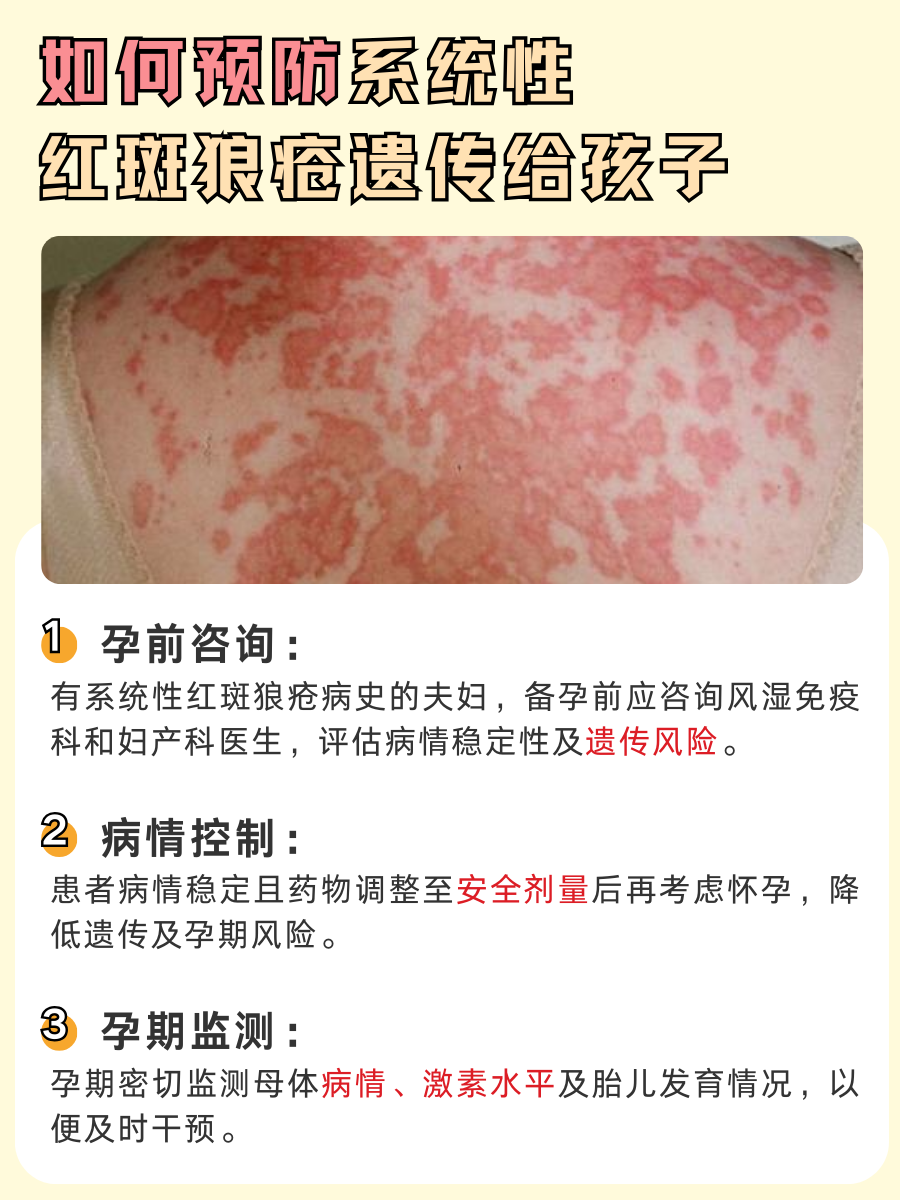 揪心！系统性红斑狼疮会遗传给孩子吗？