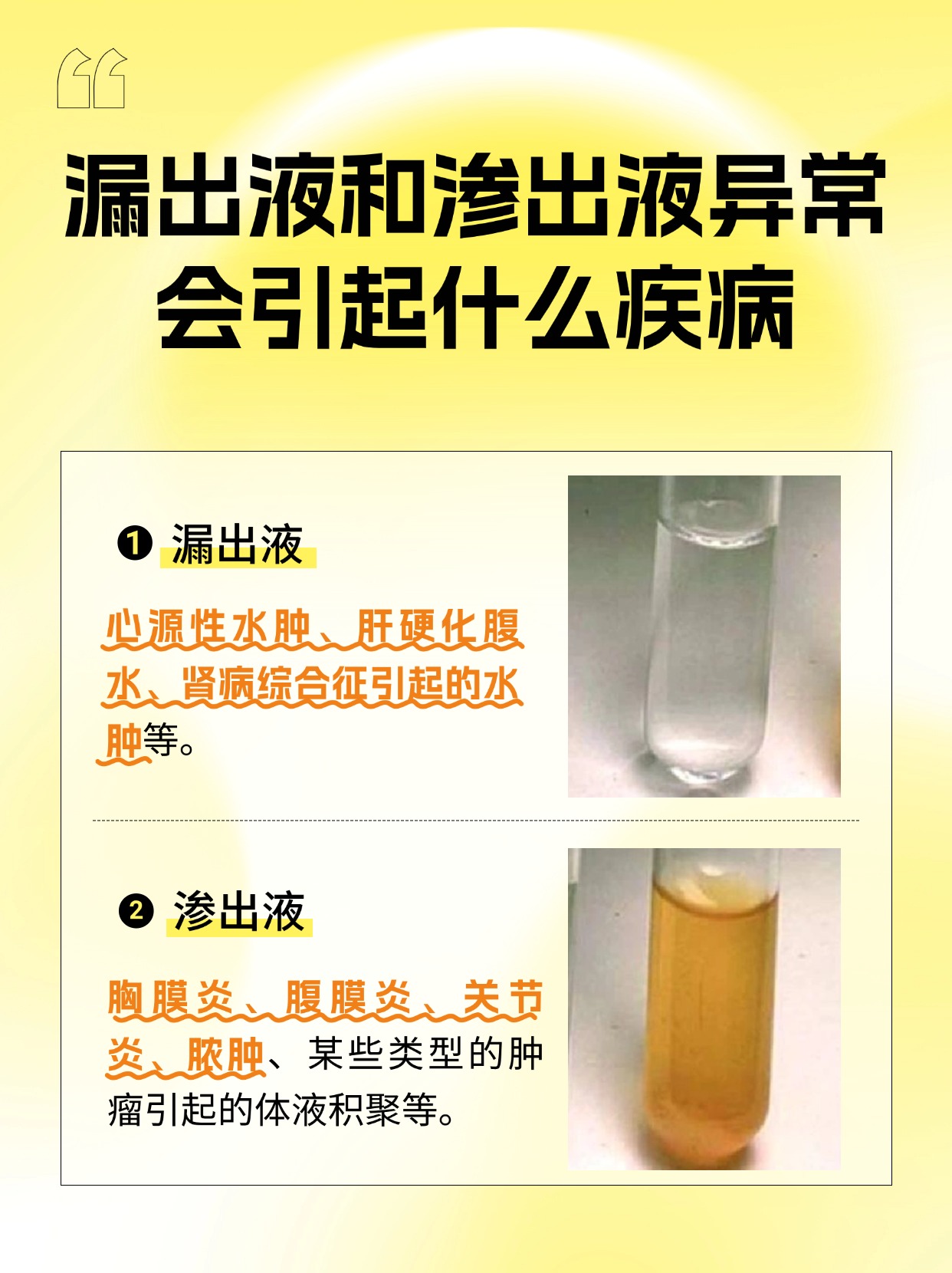 漏出液和渗出液，如何鉴别？