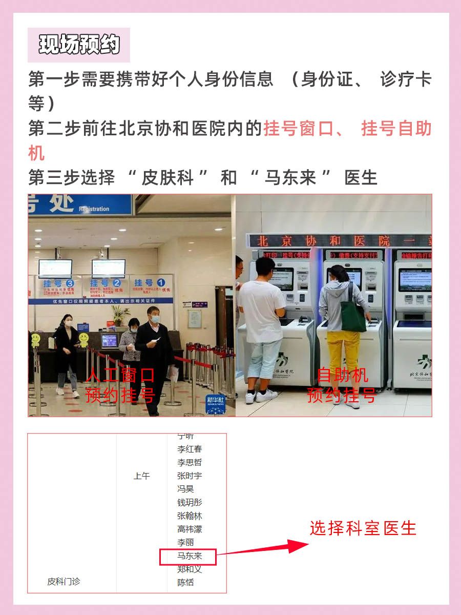 北京协和医院马东来医生怎么样？怎么挂号？