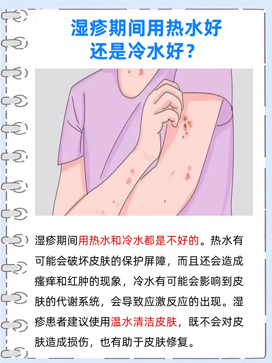 湿疹用热水还是冷水？这些小知识你还不了解吗