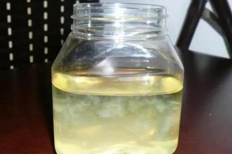 急性肾盂肾炎尿液浑浊图 急性肾盂肾炎尿液浑浊图