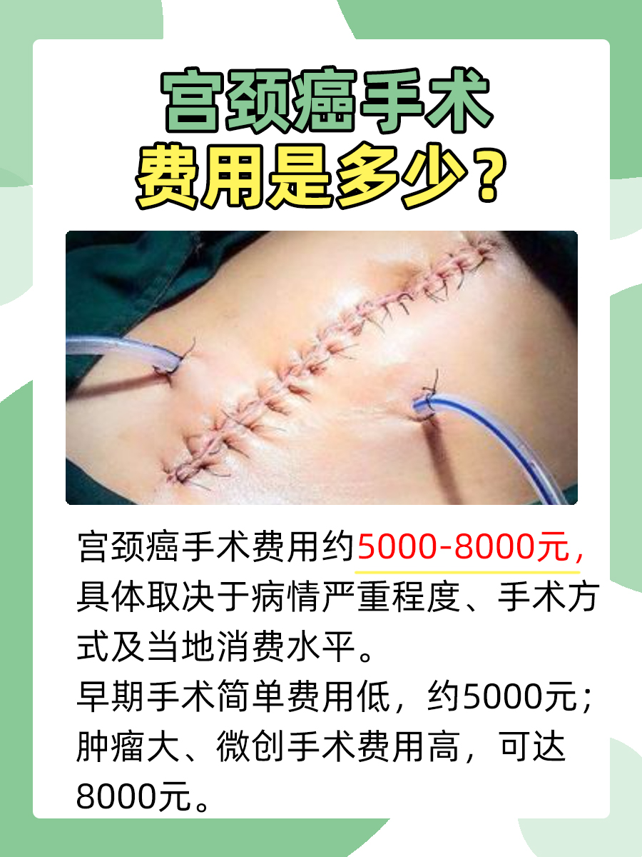 宫颈癌手术费用是多少,价钱大揭晓