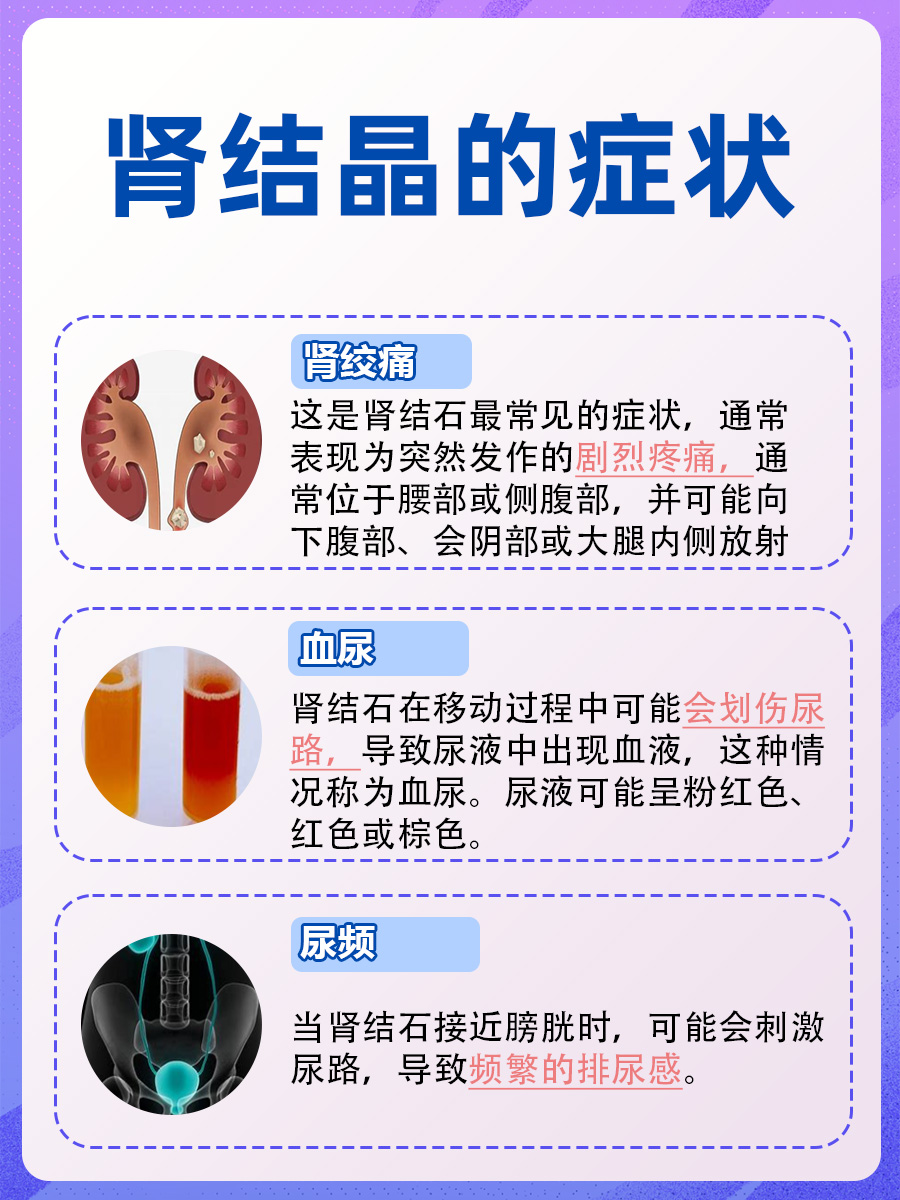 肾结晶是什么原因形成的，探究真相
