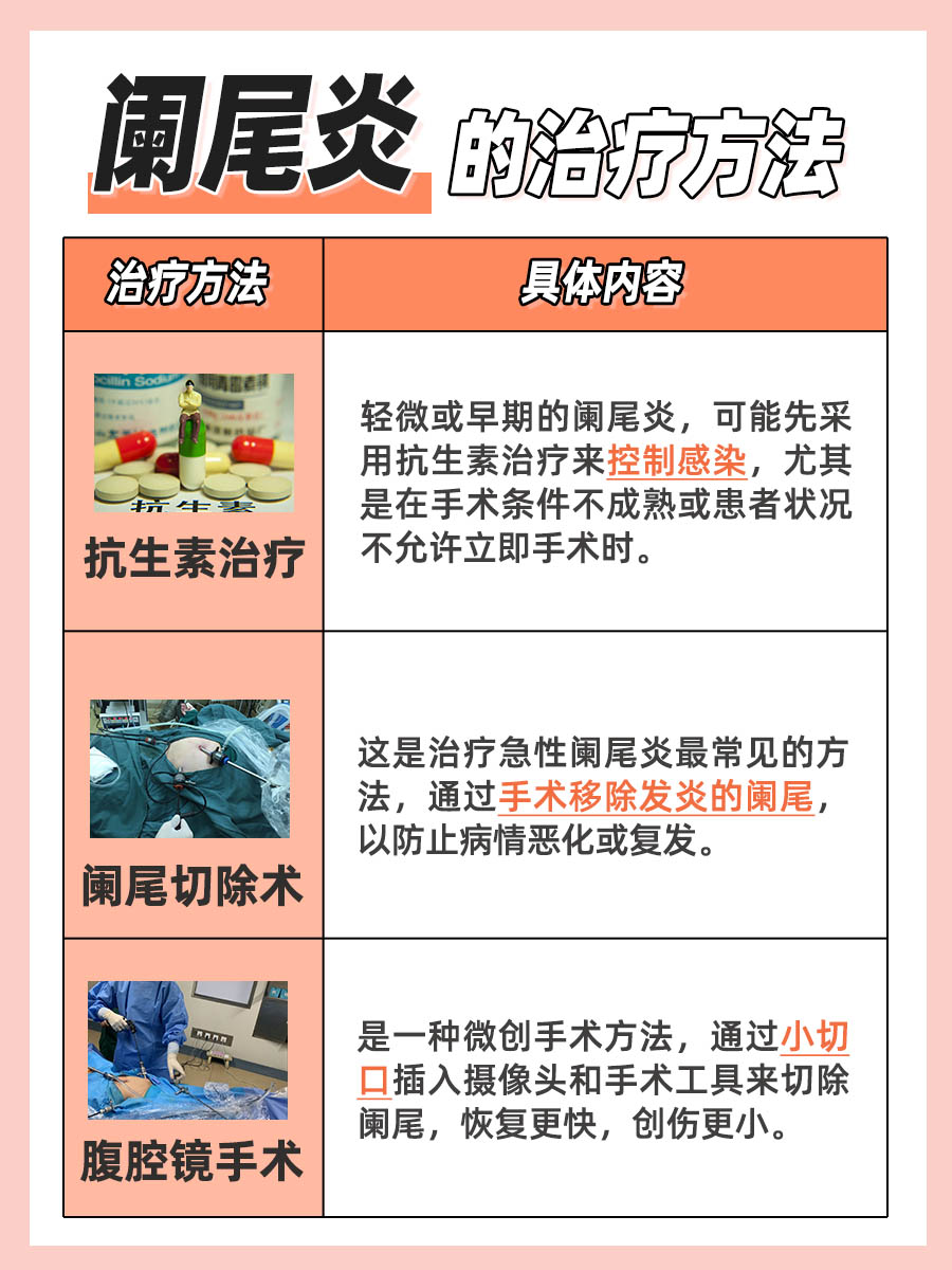 快速自查:如何初步判断是否阑尾炎