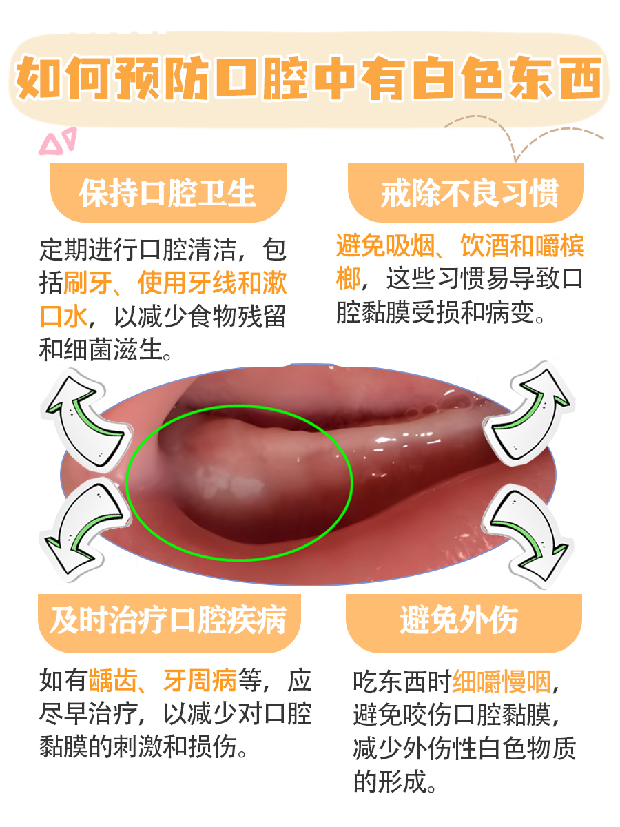 口腔里出现白色东西，究竟是什么？快来一探究竟